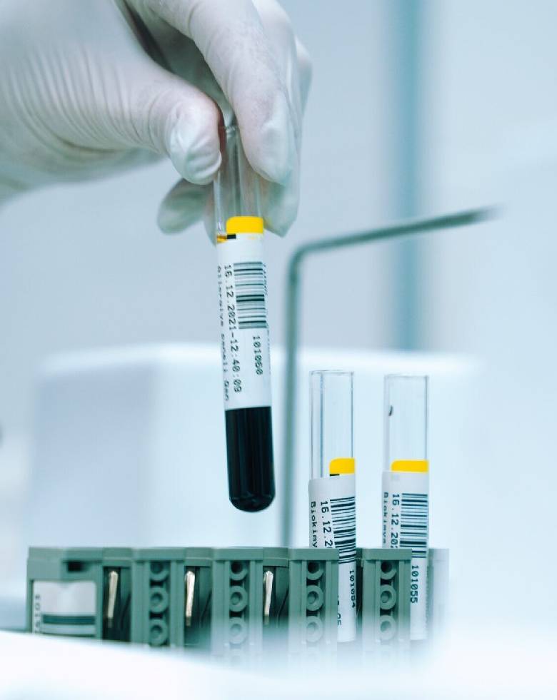 Lipid Profile (1)