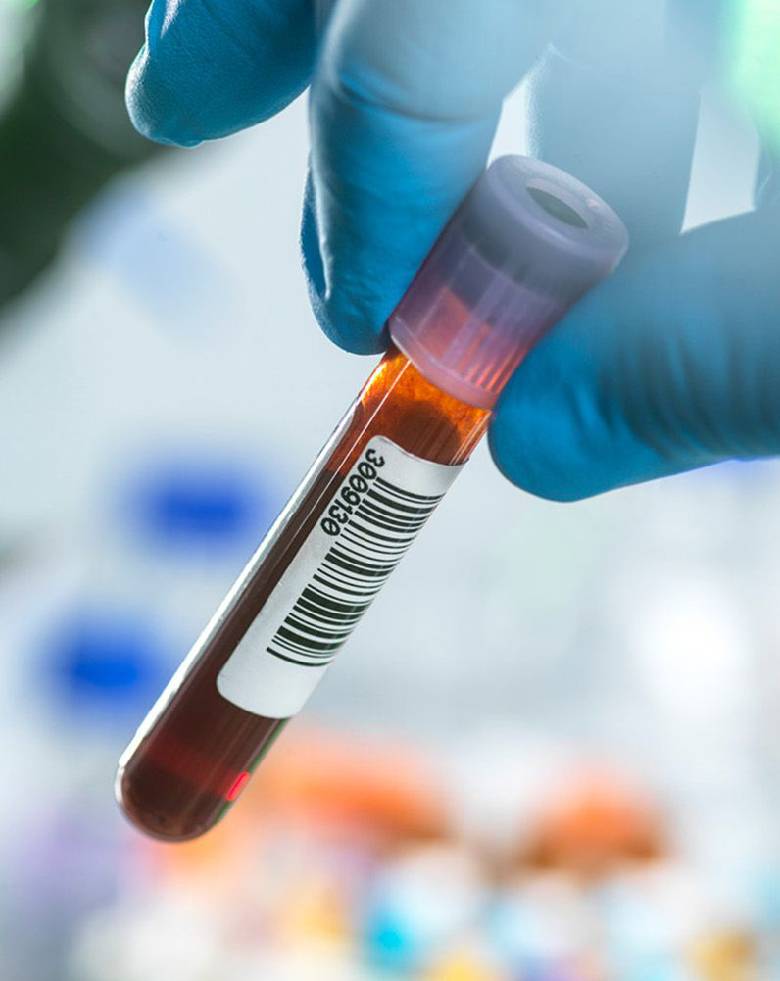 Pancreatic Function Tests2